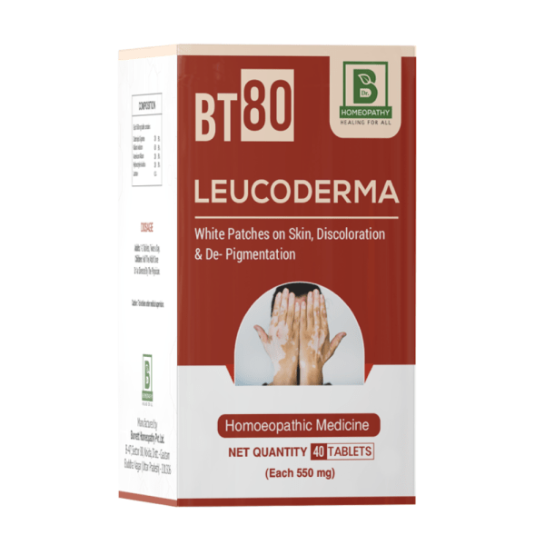 BT-80 LEUCODERMA
